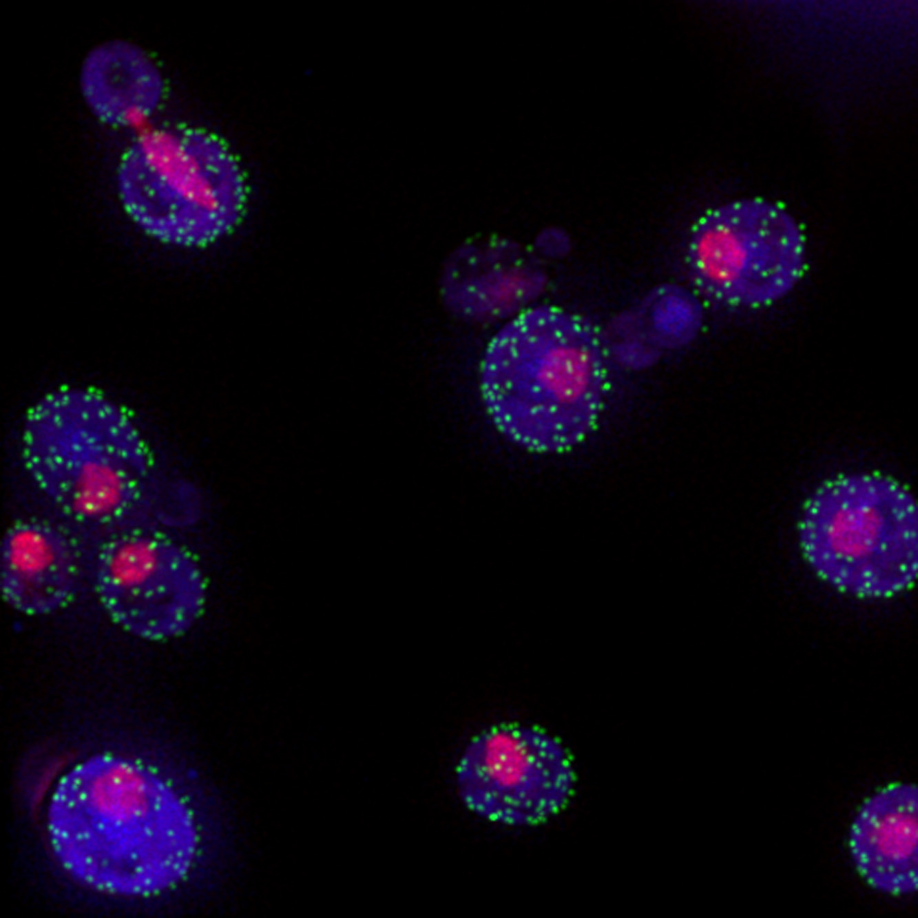 Yeast cells