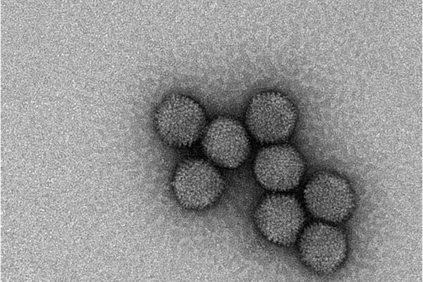 Adeno virus taken at 57,000x on the Talos