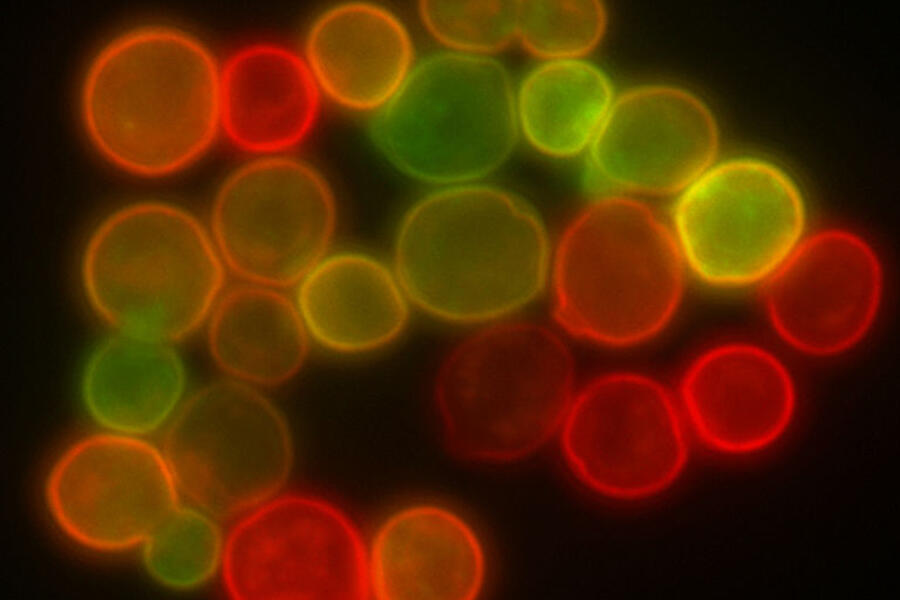 Yeast cells labeled with colourful fluorescent markers (Credit: Wiki Commons)
