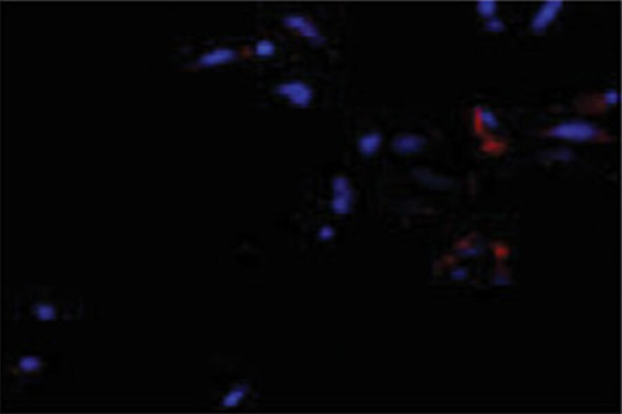 Aged stem cell after growth factors added