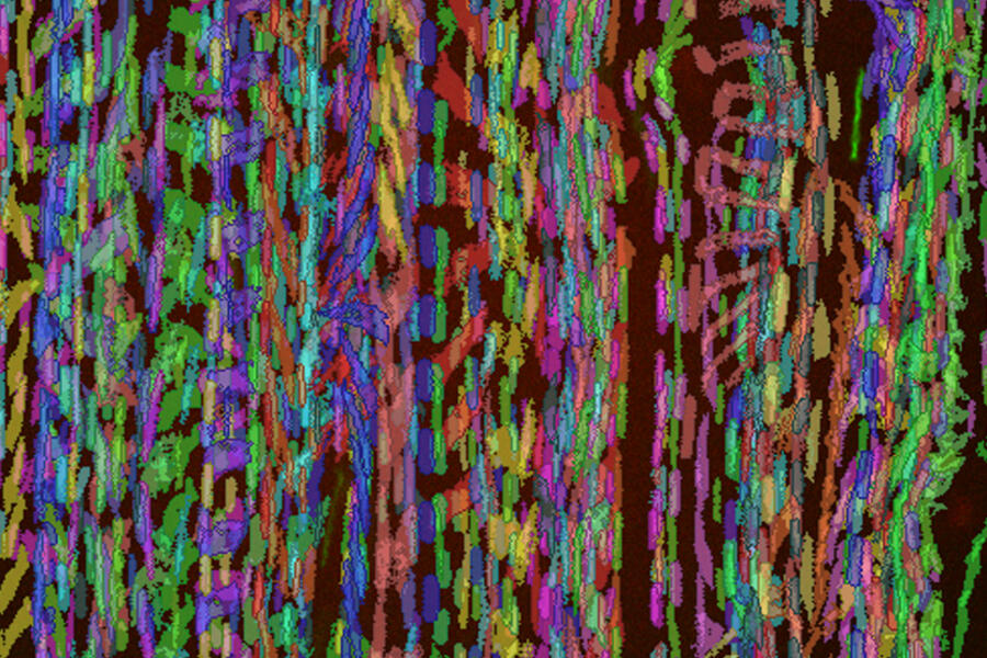 Borrelia burgdorferi, shown in unique colours, interacting with the surface of endothelial cells