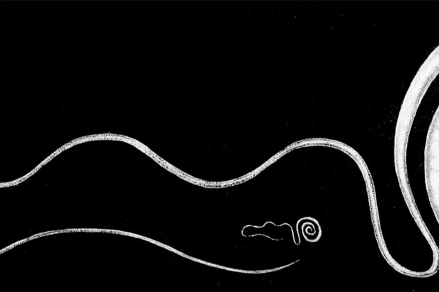 Trichuris_trichiura