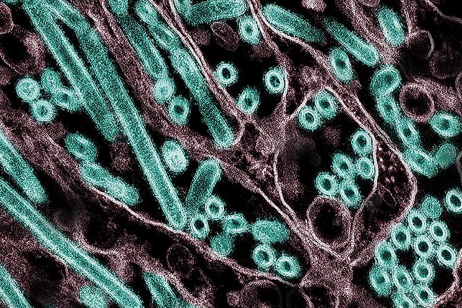 A transmission electron micrograph of avian influenza A H5N1 virus particles (green), grown in epithelial cells.