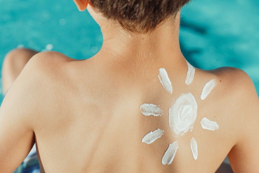 Photo of the back of a light skinned boy beside a pool with a sun sketched on his shoulder in white sunscreen. Photo by Kindel Media from Pexels