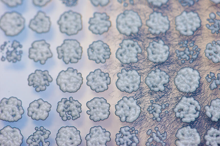 COLONIES OF BAKER'S YEAST CELLS GROWING IN A PETRI DISH