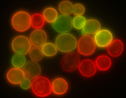 Yeast cells labeled with colourful fluorescent markers (Credit: Wiki Commons)