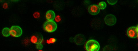 Glowing proteins in cells – yeast cells expressing proteins that carry green and red fluorescent tags to make them visible. (Credit: Brandon Ho) 