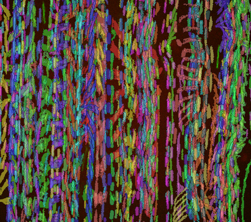 Borrelia burgdorferi, shown in unique colours, interacting with the surface of endothelial cells