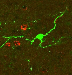 Neurons in the ACC