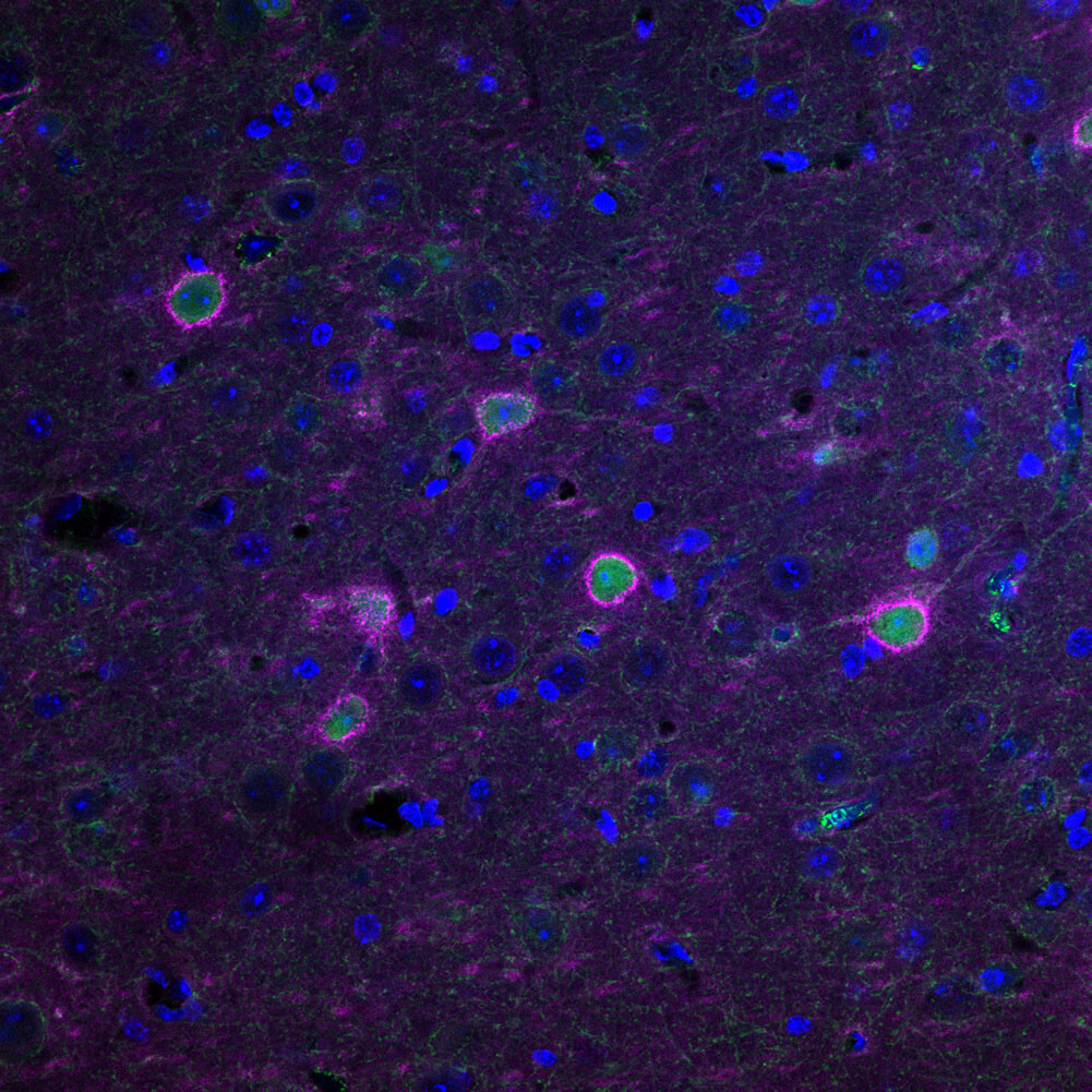 Chemogenetics rescues the health of perineuronal nets (pink) that surrounds neurons (green) in the ALS mouse brain.