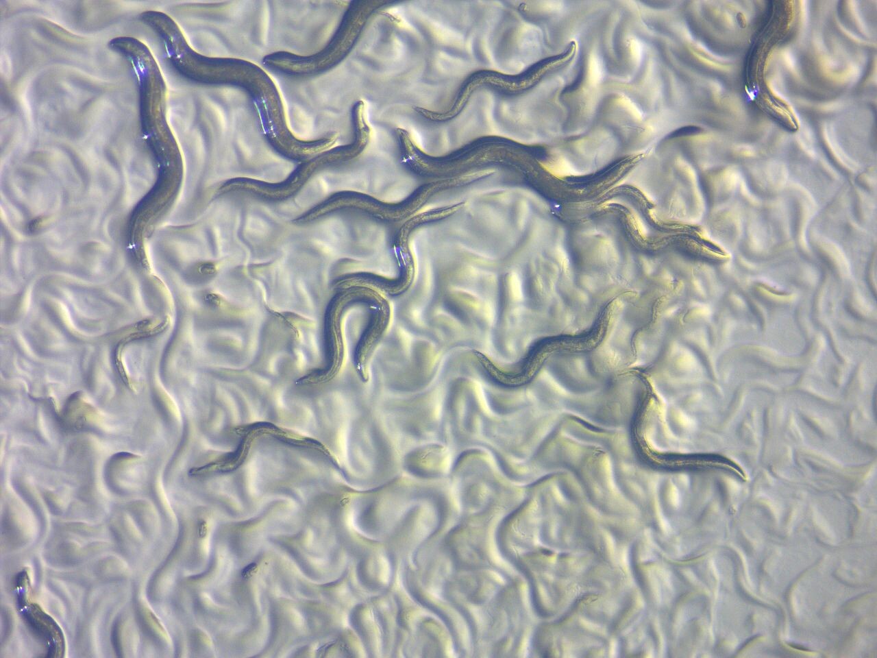 C. elegans under microscope