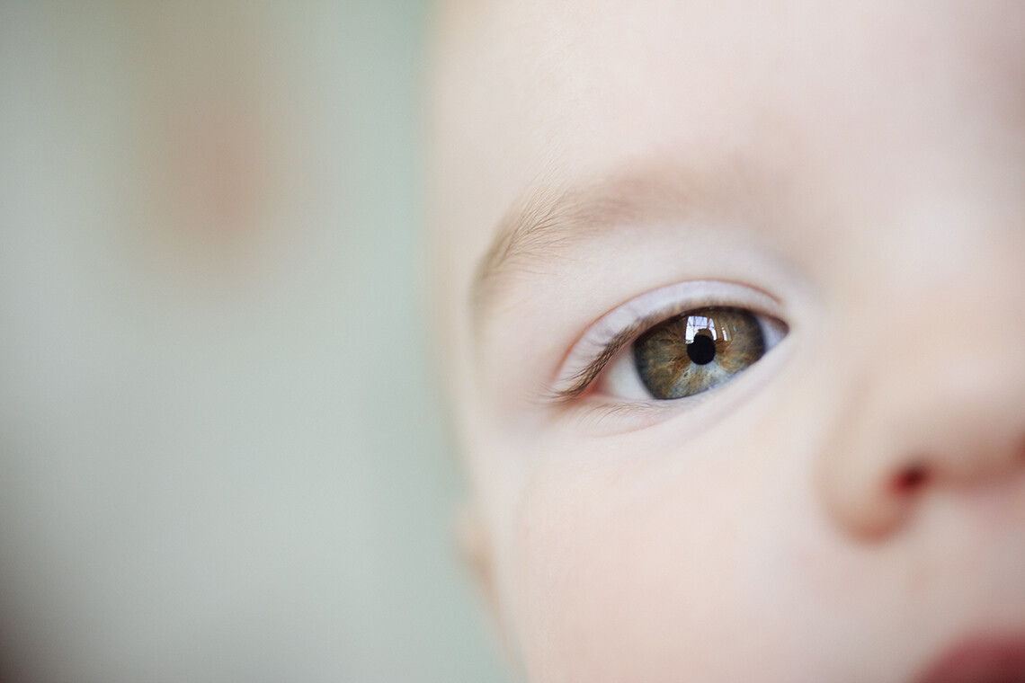 New research suggests gene therapy may be able to correct vision loss in Usher syndrome.