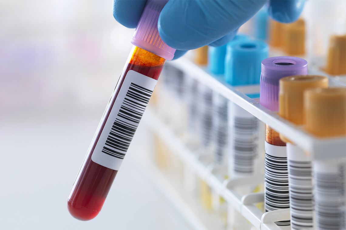 A gloved hand holds a vial of blood.