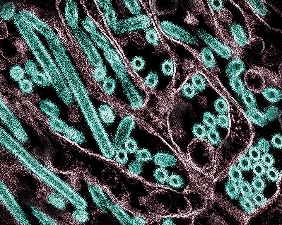 A transmission electron micrograph of avian influenza A H5N1 virus particles (green), grown in epithelial cells.