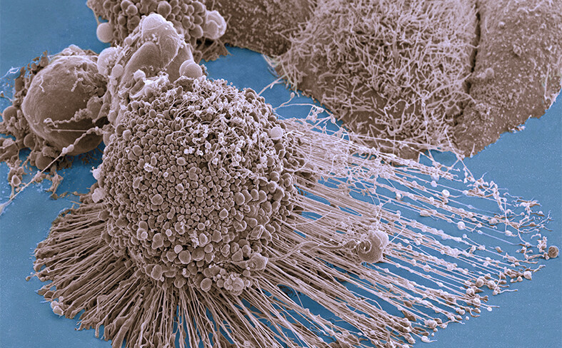 cancer cells dividing in a laboratory dish