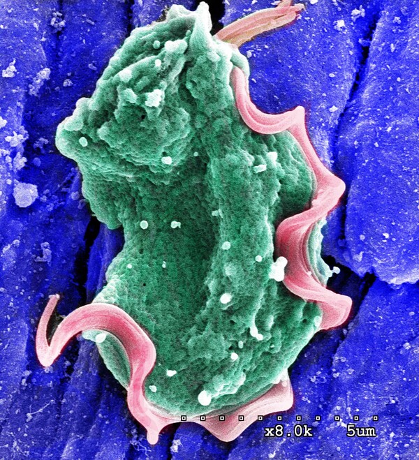 A colourized scanning electron micrograph of the protozoan Tritrichomonas muscles