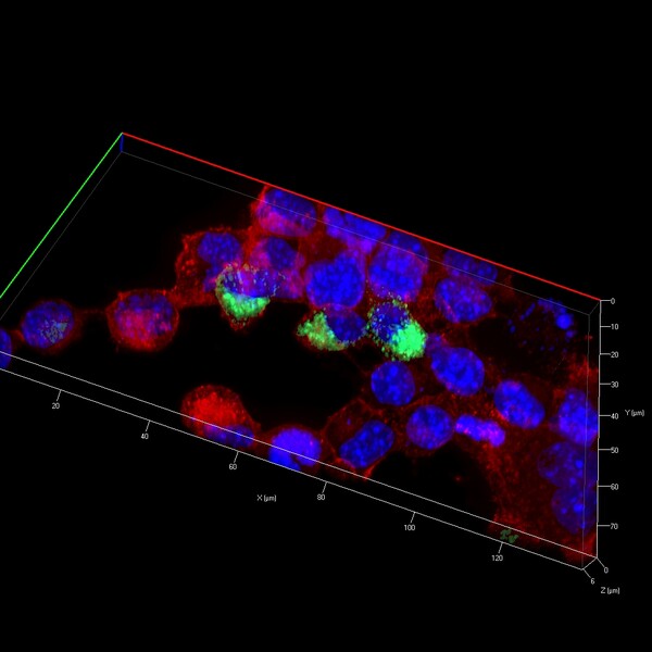 MIL Disk Confocal
